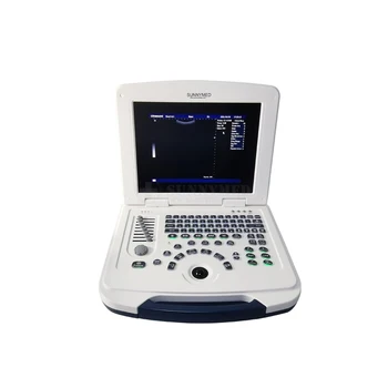 Prodaja mini ultrazvučni aparat SY-A007B, Laptop, Crno-Bijeli Ultrazvučni skener, Dijagnostičke opreme 2D